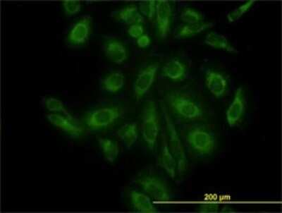 Immunocytochemistry/ Immunofluorescence: ACTR3 Antibody (2B6) [H00010096-M02]