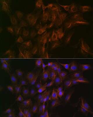 Immunocytochemistry/ Immunofluorescence: ACTR3 Antibody (8K4F2) [NBP3-16424]