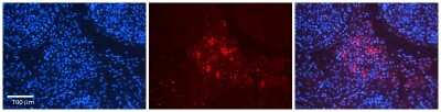 Immunohistochemistry: ACTR3 Antibody [NBP1-56406]