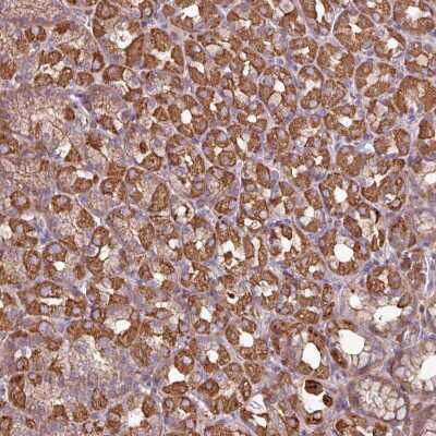 Immunohistochemistry: ACTR3 Antibody [NBP2-33623]
