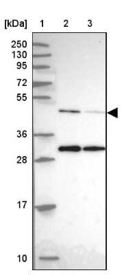 Western Blot: ACTR3 Antibody [NBP2-33623]