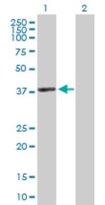 Western Blot: ACTRT2 Antibody [H00140625-D01P]