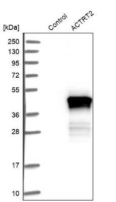 Western Blot: ACTRT2 Antibody [NBP1-89006]
