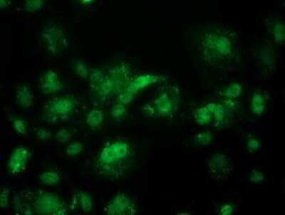 Immunocytochemistry/ Immunofluorescence: ACY3 Antibody (OTI2D5) [NBP2-03512]
