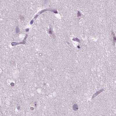 Immunohistochemistry-Paraffin: ACY3 Antibody [NBP2-48895]