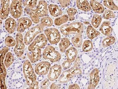 Immunohistochemistry-Paraffin: ACY3 Antibody [NBP2-99167]