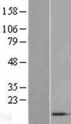 Western Blot: ACYP1 Overexpression Lysate [NBL1-07302]