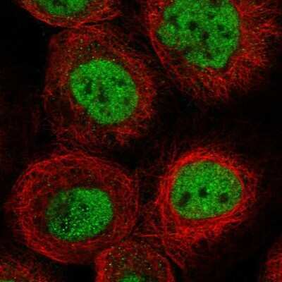 Immunocytochemistry/ Immunofluorescence: ACYP2 Antibody [NBP1-86308]