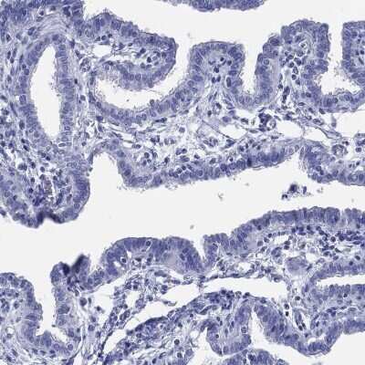 Immunohistochemistry-Paraffin: ADAD2 Antibody [NBP3-17119]