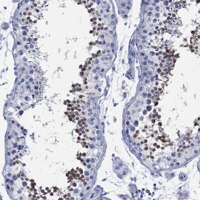 Immunohistochemistry-Paraffin: ADAD2 Antibody [NBP3-17119]