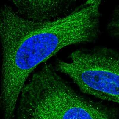 Immunocytochemistry/ Immunofluorescence: ADAL Antibody [NBP2-55056]