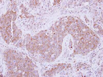 Immunohistochemistry-Paraffin: ADAM10 Antibody [NBP2-15280]