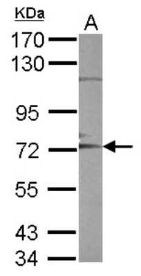 Western Blot: ADAM10 Antibody [NBP2-15279]