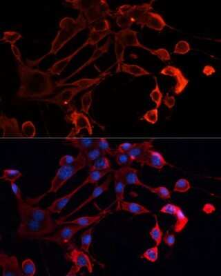 Immunocytochemistry/ Immunofluorescence: ADAM11 Antibody - Azide and BSA Free [NBP2-92621]