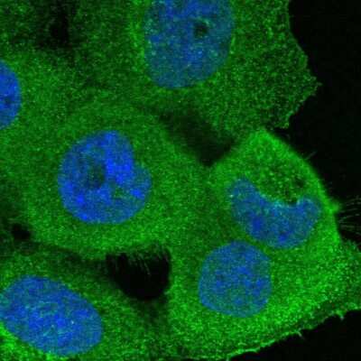 Immunocytochemistry/ Immunofluorescence: ADAM12 Antibody [NBP1-82791]
