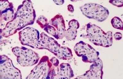 Immunohistochemistry-Paraffin: ADAM12 Antibody [NB300-889]