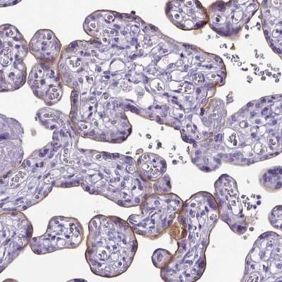 Immunohistochemistry-Paraffin: ADAM12 Antibody [NBP1-82791]