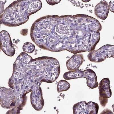 Immunohistochemistry-Paraffin: ADAM12 Antibody [NBP2-33939]