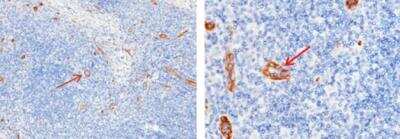 Immunohistochemistry-Paraffin: ADAM15 Antibody (007) [NBP2-89546]