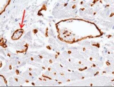 Immunohistochemistry-Paraffin: ADAM15 Antibody (007) [NBP2-89546]