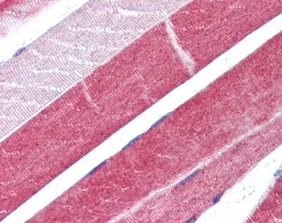 Immunohistochemistry-Paraffin: ADAM15 Antibody [NBP1-31526]
