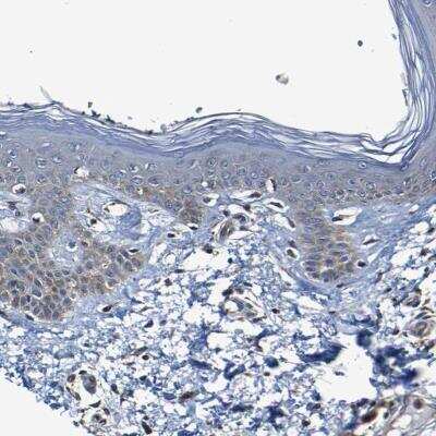 Immunohistochemistry-Paraffin: ADAM15 Antibody [NBP1-82788]