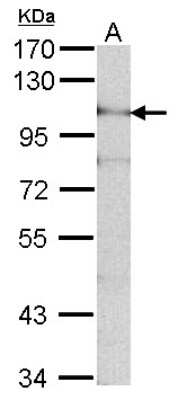 Western Blot: ADAM15 Antibody [NBP1-31526]