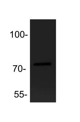 Western Blot: ADAM19 Antibody [NBP1-69364]