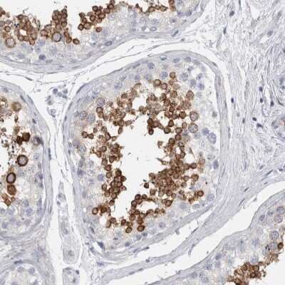 Immunohistochemistry-Paraffin: ADAM2 Antibody [NBP1-85415]