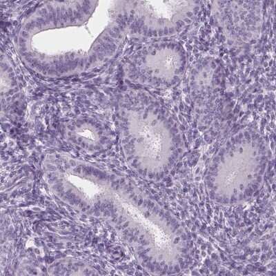 Immunohistochemistry-Paraffin: ADAM20 Antibody [NBP2-38872]