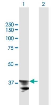 Western Blot: ADAM22 Antibody [H00053616-B01P]