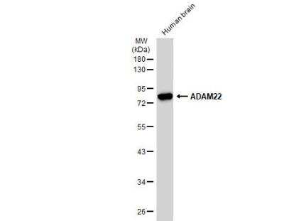 Western Blot: ADAM22 Antibody [NBP2-15282]