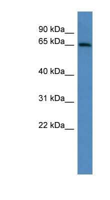 Western Blot: ADAM23 Antibody [NBP1-69016]