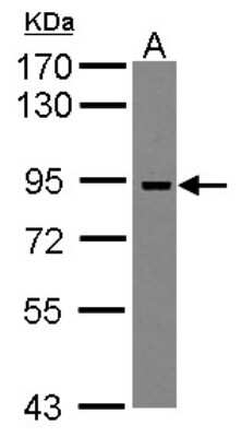 Western Blot: ADAM23 Antibody [NBP2-15283]
