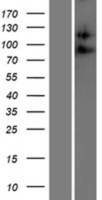 Western Blot: ADAM23 Overexpression Lysate [NBP2-07947]