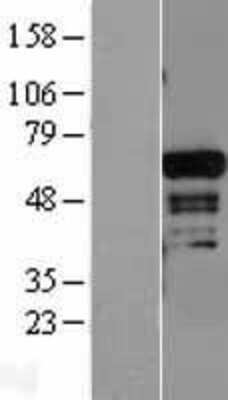 Western Blot: ADAM28 Overexpression Lysate [NBL1-07309]