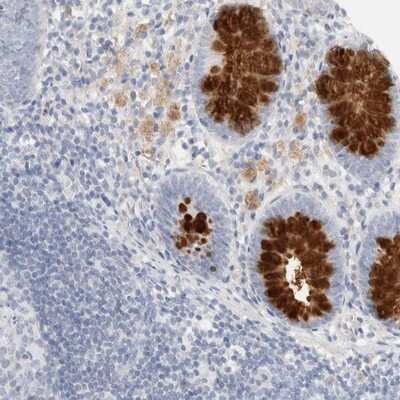 Immunohistochemistry-Paraffin: ADAM30 Antibody [NBP1-86980]