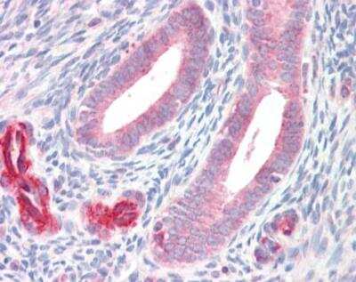 Immunohistochemistry-Paraffin: ADAM33 Antibody [NBP1-30898]