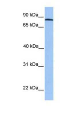 Western Blot: ADAM7 Antibody [NBP1-69366]
