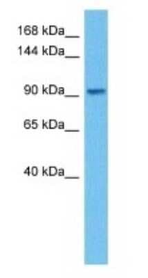 Western Blot: ADAM8 Antibody [NBP3-10837]