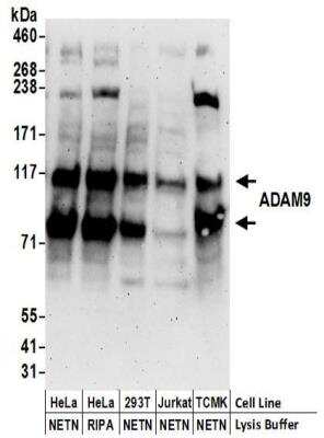 Western Blot: ADAM9 Antibody [NBP2-32260]