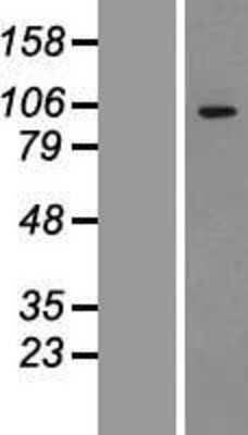 Western Blot: ADAMTS1 Overexpression Lysate [NBP2-07547]
