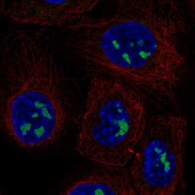 Immunocytochemistry/ Immunofluorescence: ADAMTS12 Antibody [NBP2-68996]