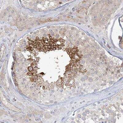 Immunohistochemistry-Paraffin: ADAMTS12 Antibody [NBP1-86296]