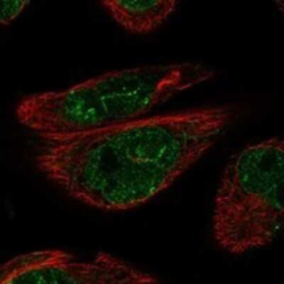 Immunocytochemistry/ Immunofluorescence: ADAMTS16 Antibody [NBP3-17147]