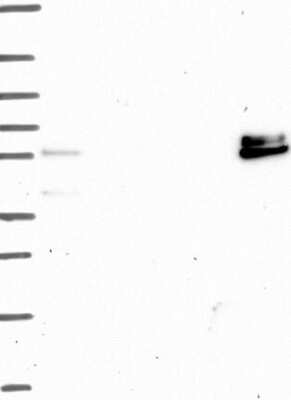 Western Blot: ADAMTS16 Antibody [NBP3-17147]