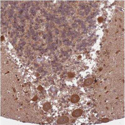 Immunohistochemistry-Paraffin: ADAMTS3 Antibody [NBP2-30495]