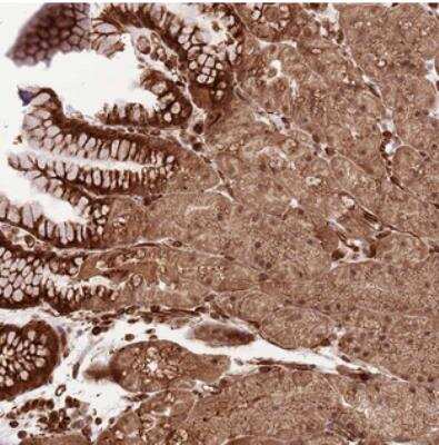 Immunohistochemistry-Paraffin: ADAMTS3 Antibody [NBP2-30775]