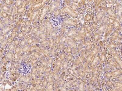 Immunohistochemistry: ADAMTS4 Antibody [NBP2-99438]