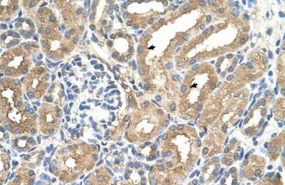 Immunohistochemistry-Paraffin: ADAMTS4 Antibody [NBP1-54369]
